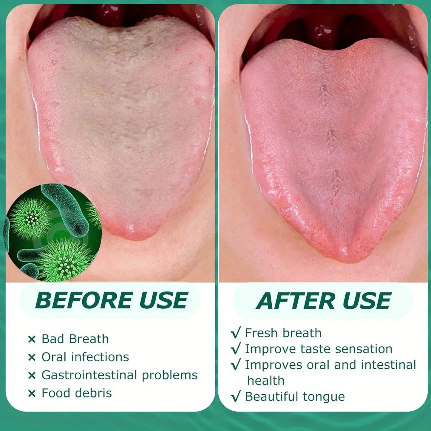 Stainless Steel Tongue Cleaner – Advanced Oral Hygiene Tool