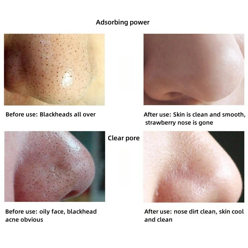 Deep-Clean Nose Pore Strips